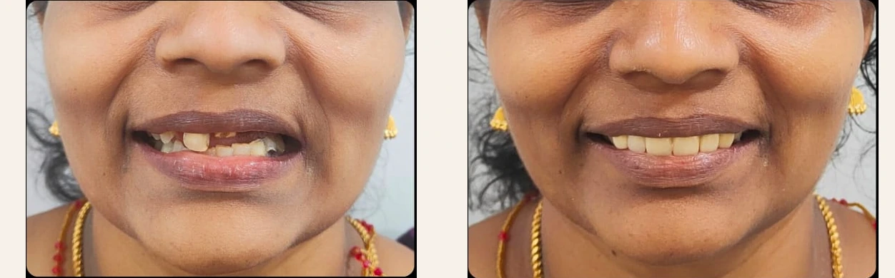 Cosmetic dentistry case with before and after smile photographs